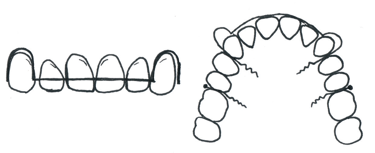 Abb. 2: Schema der Konstruktionselemente.