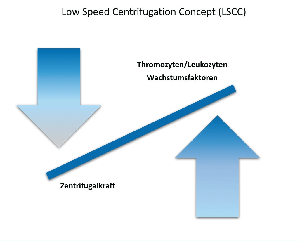 Abb. 2: Schematische Darstellung des Prinzips des Low Speed Centrifugation Concept.