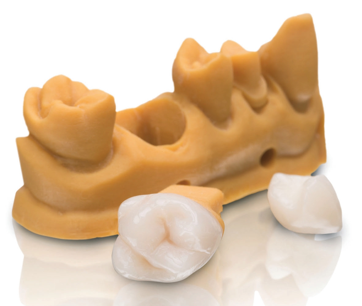 Abb. 2: VarseoSmile Crown.