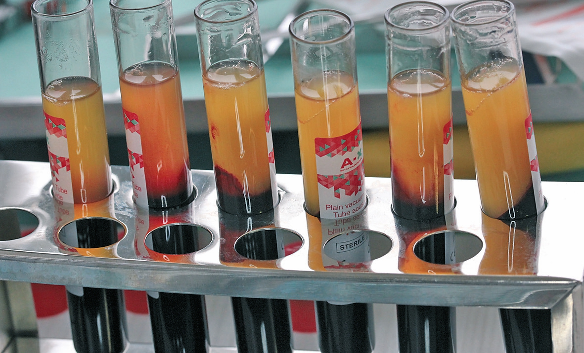 Abb. 2: Gefüllte Röhrchen nach Zentrifugation.