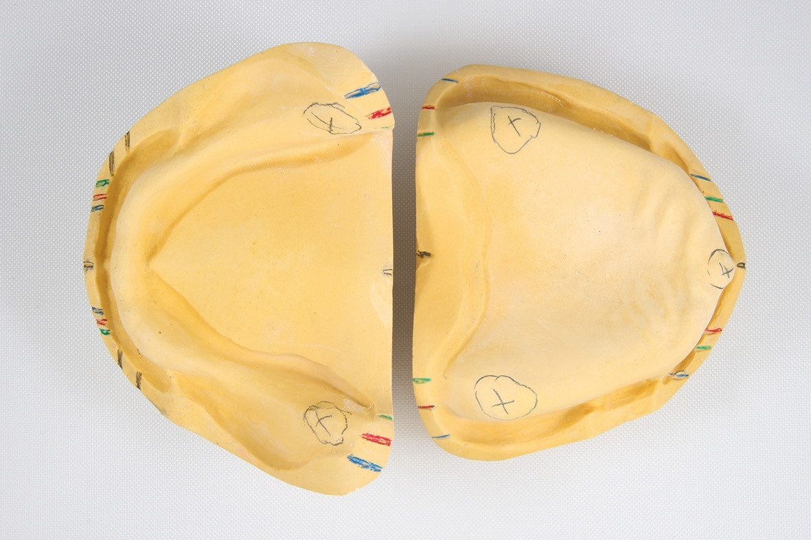 Abb. 2: Anzeichnungen der statischen Linien.