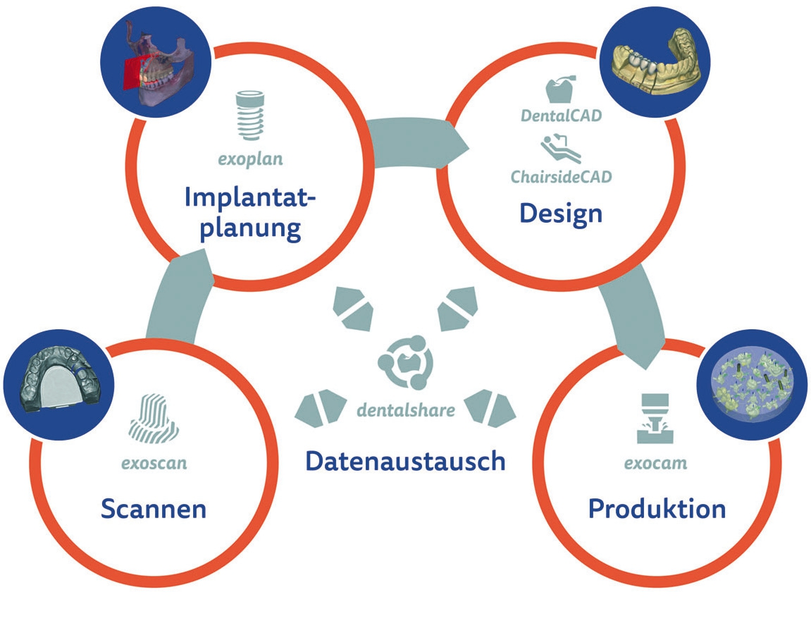 Abb. 2: Der exocad-Workflow.