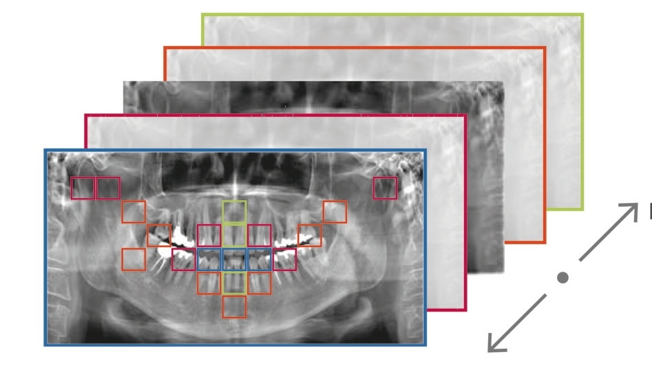 Abb. 2: Adaptive Focal Point (AFP) setzt optimale Panoramaschichten zu einem neuen Bild zusammen.