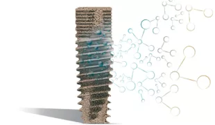 Die neu entwickelte Implantatoberfläche B+.