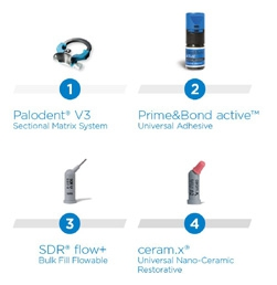 Abb. 2: Die „Class II Solution“ mit vier Produkten als integralen Bestandteilen bietet eine Komplettlösung mit vorteilhafter Adaptation für Klasse-II-Restaurationen – mit Indikation bis in den prothetischen Bereich (indirekte ästhetische Restauration mit ceram.x duo). Foto: Dentsply Sirona Restorative