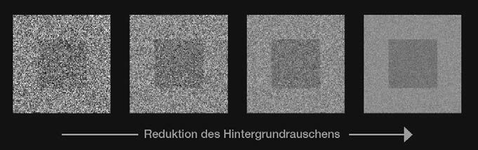 Der DEXIS®-Titanium liefert aufgrund modernster Technologien eine optimale Darstellung anatomischer Details.