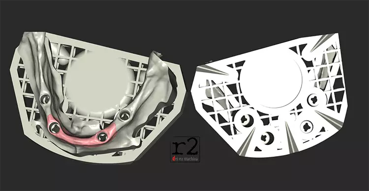 Abb. 3: Modellsystem mit integriertem Sockel bei der Software Fix-it-Erik.