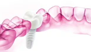 © Dentalpoint AG