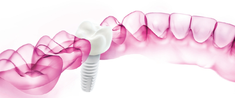 © Dentalpoint AG