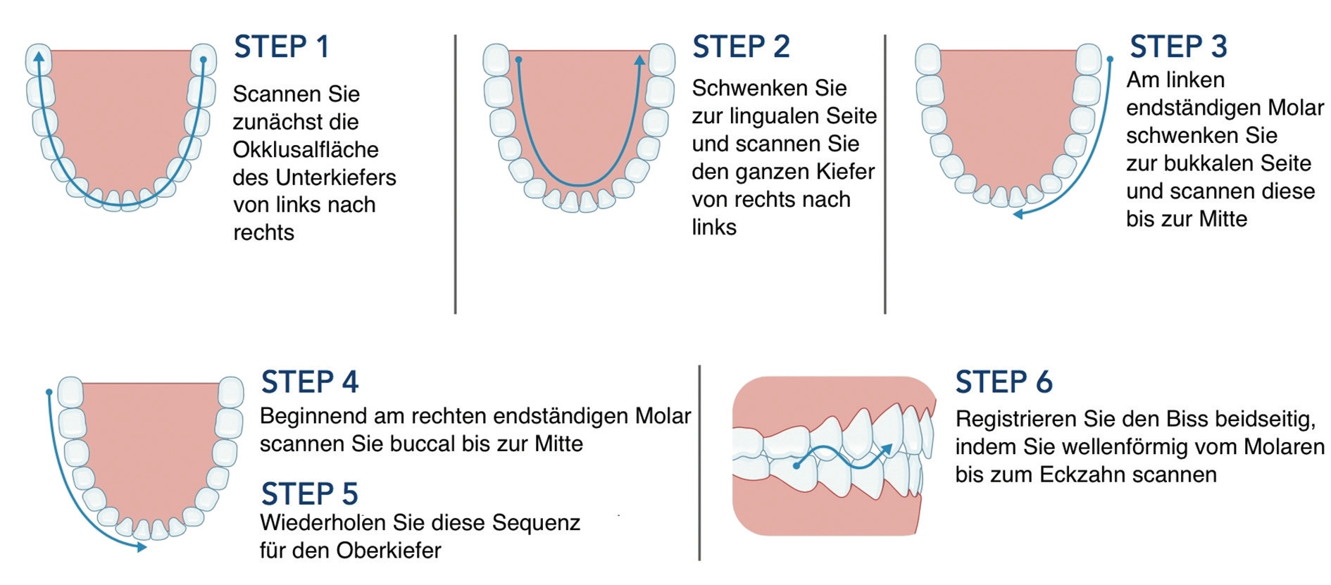 Abb. 3: Scanstrategie am Beispiel des iTero-Elements.