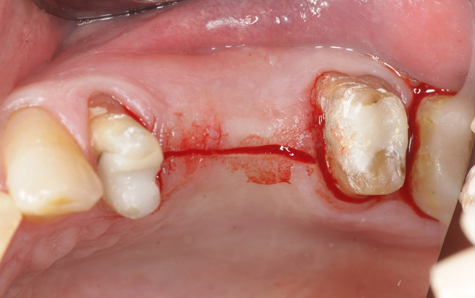 Abb. 3: Krestaler Schnitt regiones 25 und 26.