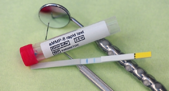 Abb. 2: Positiver aMMP8-Test zu Behandlungsbeginn.