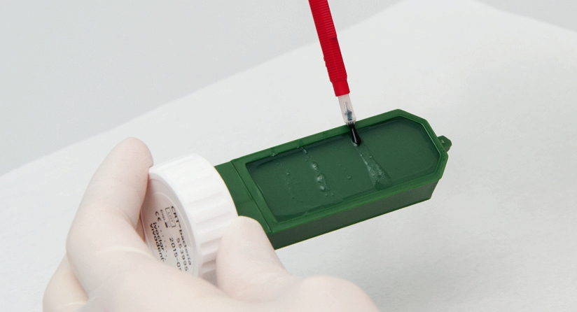 Abb. 3: Mithilfe eines biologischen Chairside-Tests lässt sich der Erfolg keimreduzierender Maßnahmen beobachten.