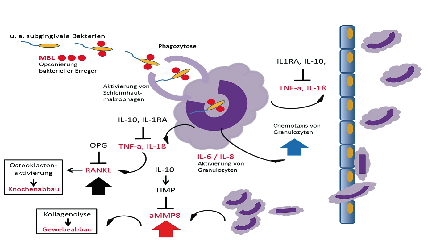 Abb. 5: Schaubild Immunpathogenese der Parodontitis, modifiziert nach Schütt (2011) (aMMP-8 = aktivierte Matrixmetalloproteinase-8, IL = Interleukin, IL-1RA Interkleukin-1 Receptor Antagonist, MBL = ..., OPG = Osteoproteerin, RANKL = Receptor Activator of Nuclear Factor ? B Ligand, TIMP = Tissue Inhibitor of Matrixmetalloproteinase, TNF-? = Tumor Necrosis Factor ?).