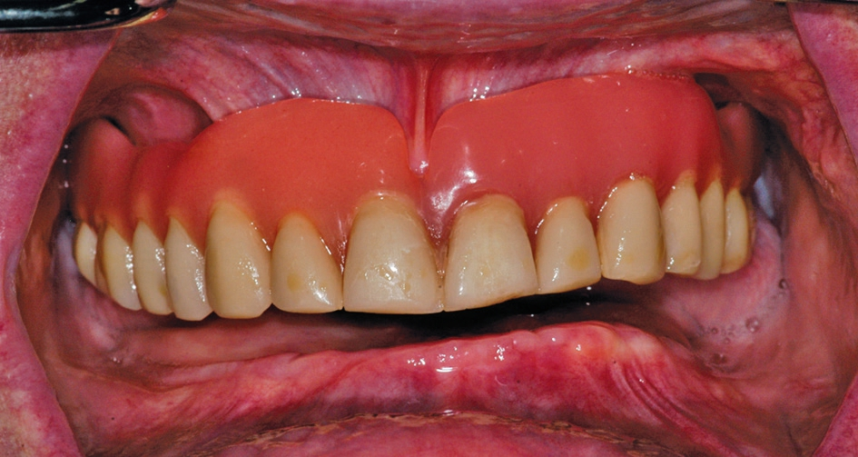 Abb. 3: Ausgangssituation intraoral.