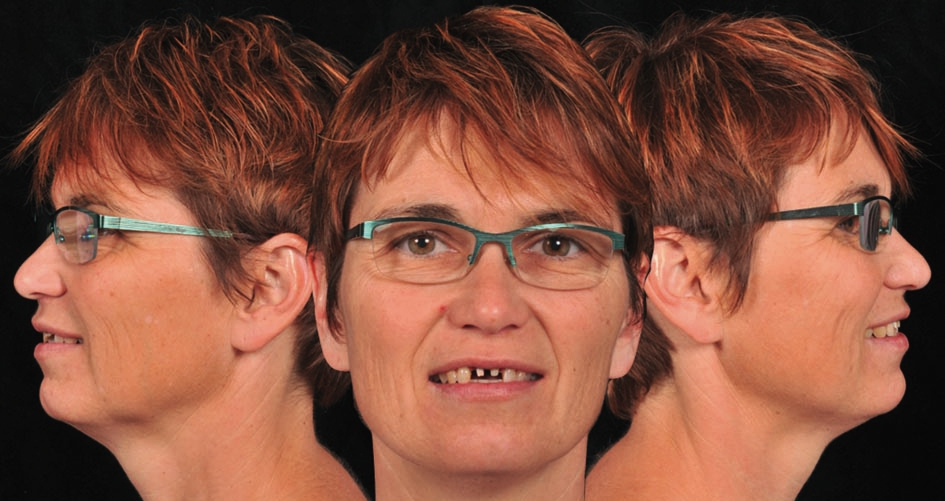 Abb. 3: Enface Aufnahme der Ausgangssituation.
