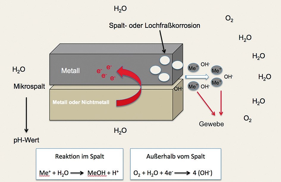Abb. 3: Schematische Darstellung der Spalt- oder Lochfraßkorrosion.