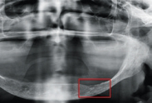 Abb. 4: PAN, UK, Region of Interest (ROI).