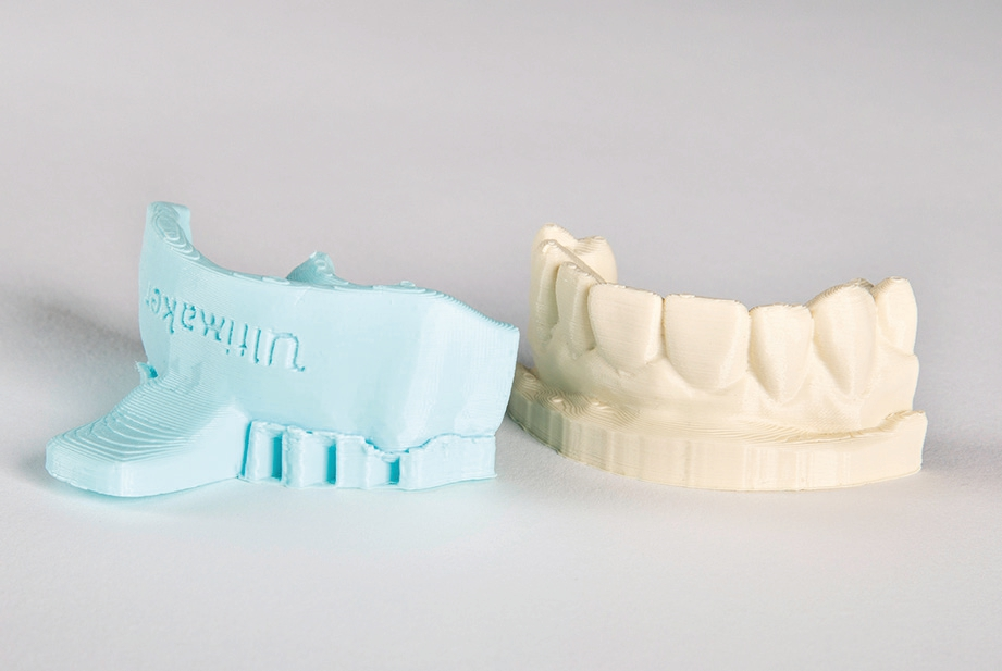 Abb. 3: Löffelgriffe können in der Software individuell gestaltet und ebenso wie die Modelle gedruckt werden.