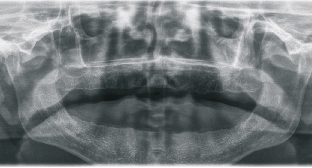 Abb. 3: OPG der Ausgangssituation.
