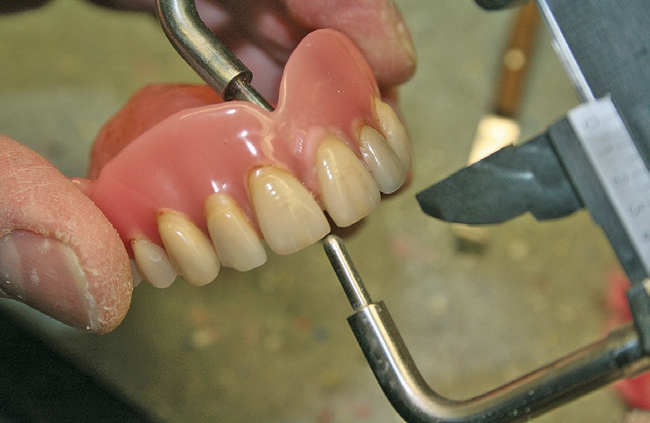 Abb. 2b: Abstand der Papilla incisiva zur Schneidekante (11/12).