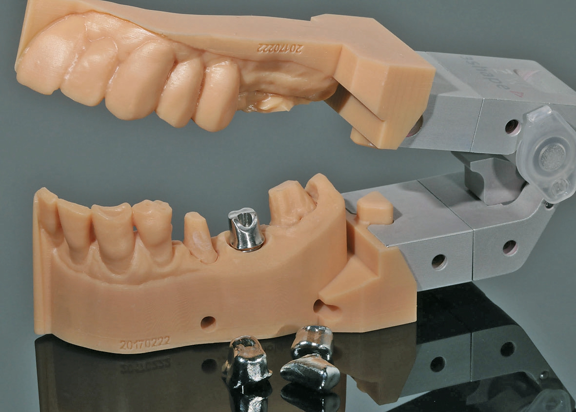 Abb. 2b: Aus dem Vollen gefrästes Abutment auf gedrucktem Modell.