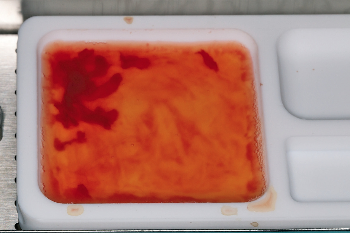 Abb. 3: Großvolumige PRF-Membran aus dem Inhalt mehrerer Vacuetten hergestellt.