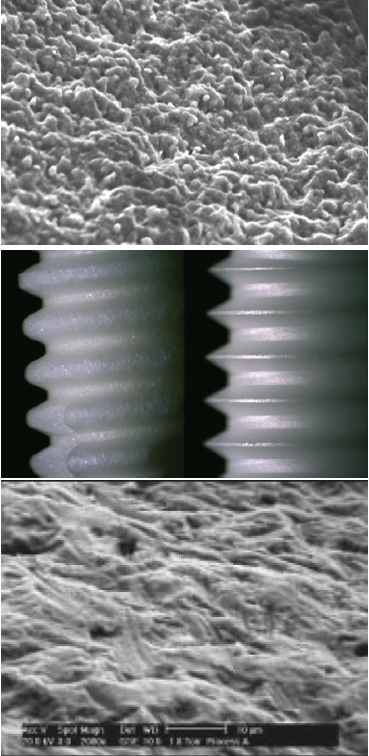 Abb. 3-5: Links die raue Oberfläche des BioWin! Implantats, rechts die „glatte Oberfläche“ eines Zirkon-Implantats eines bekannten Herstellers, sie wurde durch Lasern und Bestrahlung nach dem Sintern des bereits endgehärteten, gehippten Zirkons erzeugt. Es ist nach etlichen Studien und auch meiner eigenen Erfahrung nicht möglich, ausreichend raue Oberflächen auf dem bereits gehippten und gesinterten Zirkon zu schaffen, weder mit Säureätzung, Bestrahlung noch mit einem Laserverfahren.