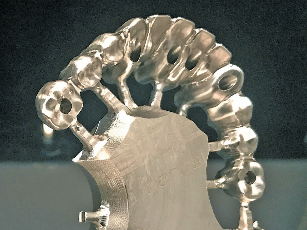 Abb. 5: Gefrästes Brückengerüst mit abgewinkelten Schraubenkanälen für das BHS30 System (seramicCAM, Bottrop).