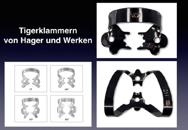 Abb. 2: Tigerklammern mit mehreren Zähnen bieten einen sicheren Halt.