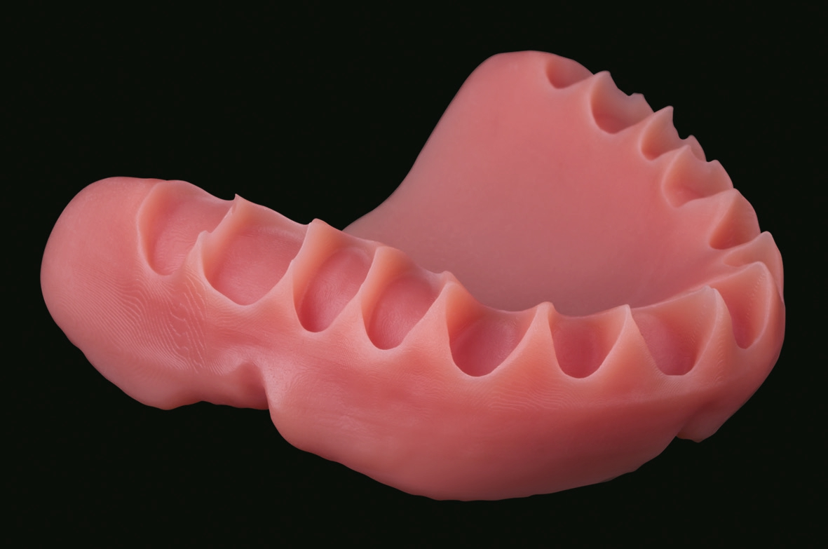 Abb. 3: 3D-gedruckte Prothesenbasis mit dem FotoDent® denture-Material von Dreve Dentamid.