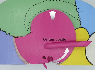 Abb. 3: Funktionsmodell des Os temporale: Kranialbewegung mit Außenrotation der Squama.