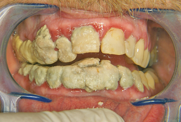 Abb. 3: Frontale Aufnahme, Ausgangssituation.
