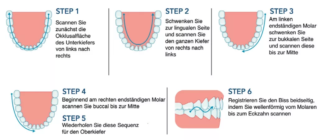 Abb. 3: Der vorgegebene Scanpfad sollte mit Blick auf ein präzises Ergebnis unbedingt eingehalten werden.