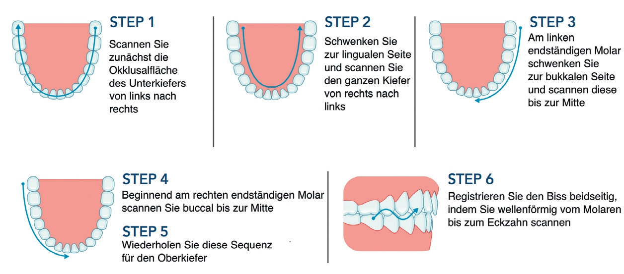 Abb. 3: Der vorgegebene Scanpfad sollte mit Blick auf ein präzises Ergebnis unbedingt eingehalten werden.