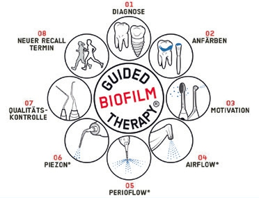 Abb. 3: Die vorliegende Anwendungsuntersuchung wurde im Rahmen einer standardisierten, systematischen Recall-Sitzung nach dem Prinzip der Guided Biofilm Therapy® durchgeführt.