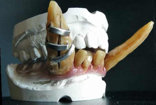 Das Gebiss eines Anführers – dieser Troll findet sich mit dem Zahnschmuck bestimmt außergewöhnlich schön. Imposant ist er allemal.