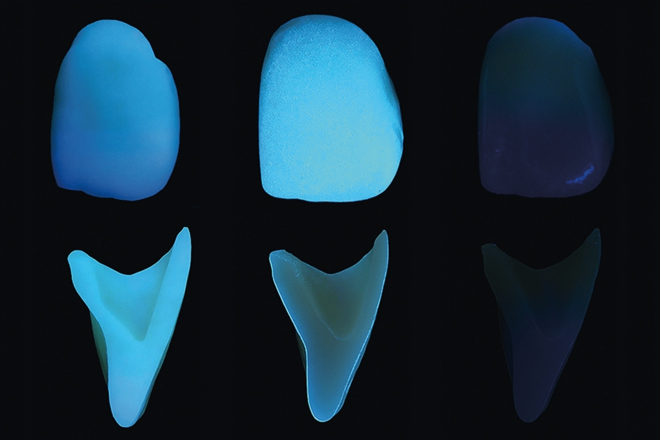 Abb. 2: Fluoreszenz von Lava Esthetic Zirkoniumoxid (links) sowie einem anderen kubischen Multilayer-Zirkoniumoxid mit (Mitte) und ohne fluoreszierende Glasur (rechts). Das Bild oben zeigt jeweils die Ansicht von labial, unten ist ein Querschnitt abgebildet, der den Unterschied zwischen inhärenter und oberflächlich applizierter Fluoreszenz sichtbar macht.