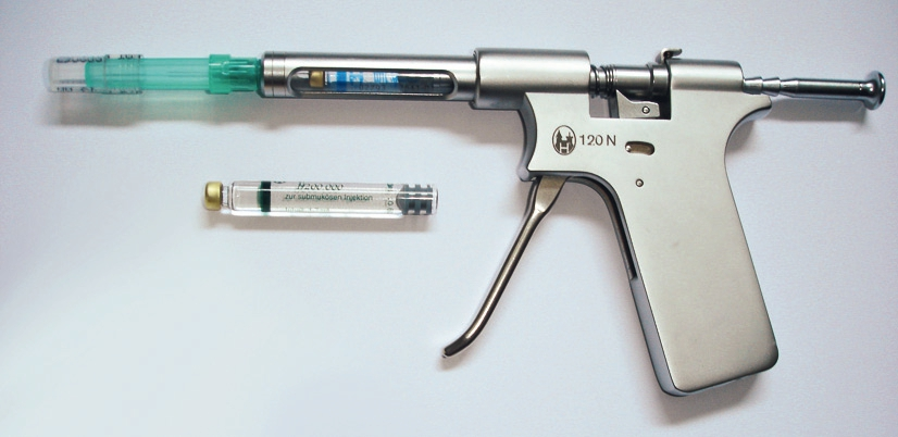 Abb. 4: Pistolenspritze Ultraject mit integriertem Druckbegrenzungsmechanismus.