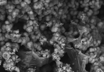 Abb. 4: Erkennbare Bildung von Hydroxylapatitkristallen unter dem Rasterelektronenmikroskop, 2.500-fache Vergrößerung. Bildquelle: COLTENE.