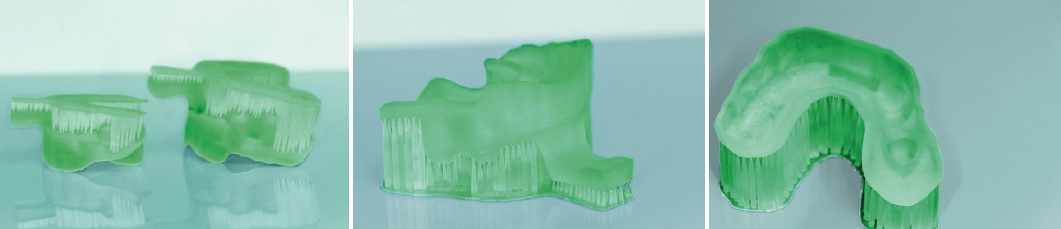 Abb. 4a-c: Individuelle Löffel, gedruckt aus Freeprint® tray UV.
