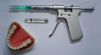 Abb. 1: Pistolenspritze mit Druckbegrenzungsmechanismus.