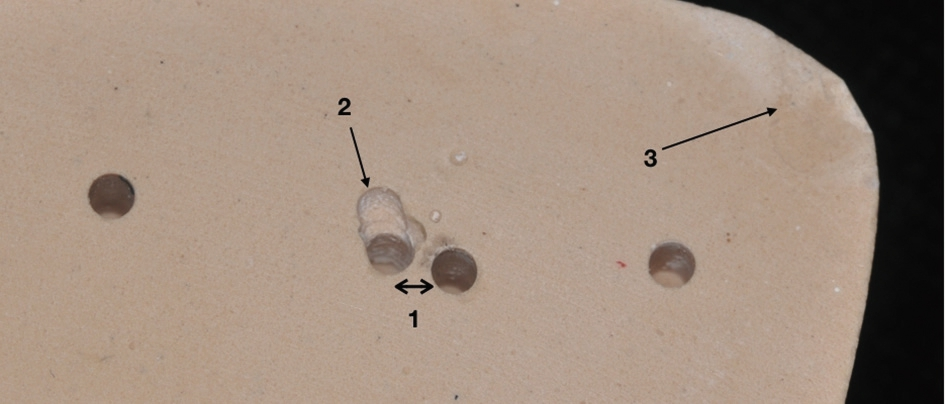 Abb. 4: Zu nah nebeneinander gesetzte Pinbohrungen (1), Fehlbohrversuch (2) und Aussprengungen am Rand (3) setzen die Qualität des Modells deutlich herab.