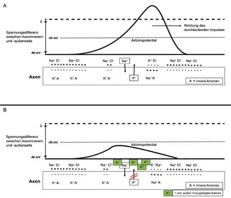 Abb. 2: Schematische Darstellung des Verlaufs eines Aktionspotenzials. (A) Ein Ausstrom von Kaliumionen aus dem Inneren des Axons (Nerv) bei zeitgleichem Einstrom von Natriumionen führt zu einer Spannungsdifferenz (-55 mV), die eine Reizweiterleitung veranlasst. (B) Durch einen Überschuss an extern hinzugegebenen Kaliumionen (z. B. durch eine Zahnpasta mit Kaliumsalzen) kann das Gleichgewicht im Nerv verschoben und somit die Nervendepolarisation blockiert werden. Der Kaliumausstrom wird inhibiert und das Aktionspotenzial kann nicht ausgelöst werden.