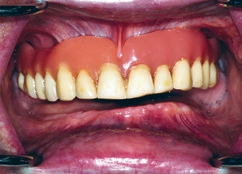 Abb. 3: Ausgangssituation intraoral.