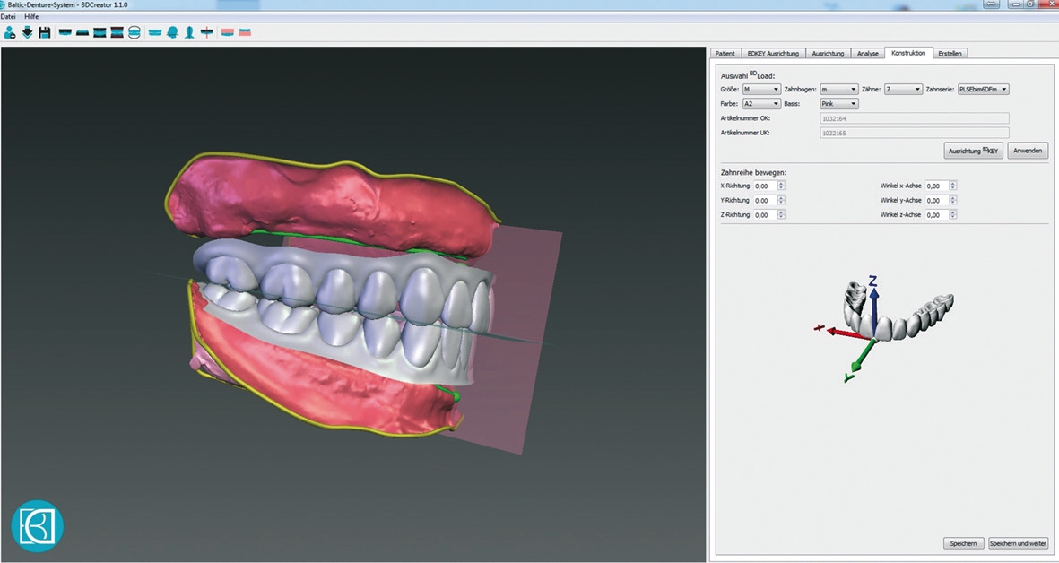 Abb. 4: Prothese im Balticum Denture System Creator Programm ? Relation Zähne zu Zahnfl eisch.