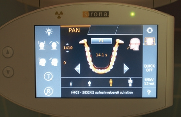 Abb. 4: Easypad des Orthophos SL, Auswahl von Aufnahmeparametern in mehreren Ebenen.
