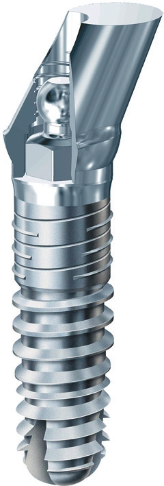 Abb. 4: …wird für festsitzenden Zahnersatz mit dem kugelförmigen Implantatkopf verklebt. Bildquelle: m&k gmbh