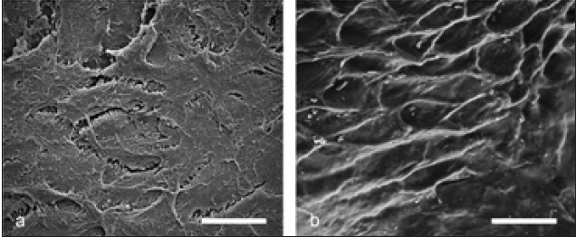 Abb. 4a: Auf der Wurzeloberfläche haften netzartig Zementoblasten am Wurzelzement und bilden eine biologische Barriere gegen das Eindringen von Osteoklasten (Maßstabsbalken: 15 ?m). b: Analog dazu verhindern das Prädentin und die darauf liegenden Pulpazellen im Zahninneren die Resorption von Zahnhartgewebe (Maßstabsbalken: 5 ?m).