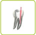 Postendodontischen Versorgung.